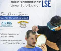 The Best Hair Transplant in Islamabad