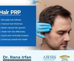 BEST PRP HAIR TREATMENT IN ISLAMABAD