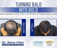 HAIR TRANSPLANT SURGERY IN ISLAMABAD