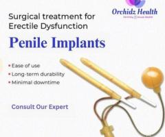 Orchidz Health Offers Confidential Solutions for Erectile Dysfunction in Bangalore