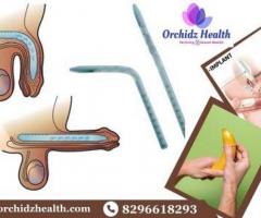 Premium Penile Implant Surgery with Orchidz Health in Bangalore