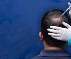 Hair fall Treatment | Baldness & Hair Loss Treatment for Men & Women