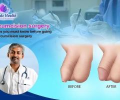Premium Circumcision Surgery at Affordable Rates in Bangalore - Orchidz Health