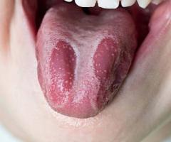 Effective Burning Mouth Syndromе Trеatmеnt - Consultation Availablе