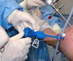 Get Appointment of Leading Shoulder Arthroscopy Surgeon in Delhi |  Dr. Shekhar Srivastav
