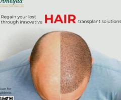 Fue hair transplant in gachibowli | hyderabad - Ameyaa clinic