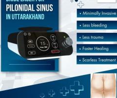 Diode Laser for Pilonidal Sinus in Uttarakhand