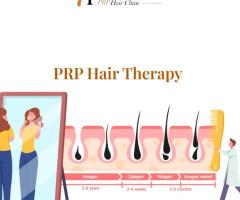 PRP Hair Therapy fresno - 1