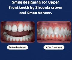 Transform Your Smile: Top-rated Dental Clinic in Seegehalli - 1