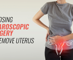 Laparoscopic Surgery to Remove Uterus | Worldofurology - 1
