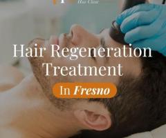 Hair Regeneration Treatment in Fresno