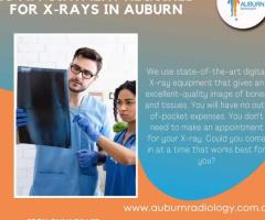 Auburn Radiology offers No appointment required for X-rays.(02) 8315 8292
