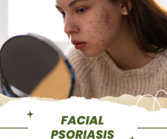 Natural Treatments for Scalp and Skin Psoriasis Effective Solutions for Lasting Relief