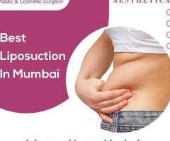 Discover the Best Liposuction in Mumbai with Dr. Vinod Vij