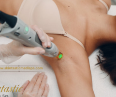 Experience Laser Hair Removal in Riverside