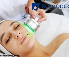 Transform Your Skin with Expert Laser Treatment for Pigmentation in Delhi at Kosmoderma