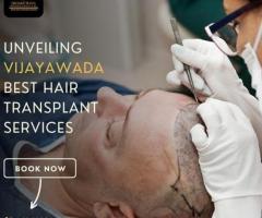 Best Hair Treatment Clinic in Vijayawada-Dr.Swetha's Hair & Skin Clinic