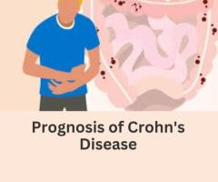 Improving the Prognosis of Crohn's Disease