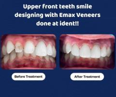 Comprehensive Dental Care Solutions in Kadugodi  Your Smile Matters