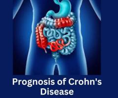 Improving the Prognosis of Crohn's Disease - 1