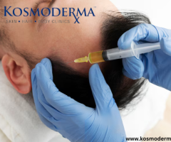 PRP Treatment for Hair Loss and Hair Fall in Delhi | Effective PRP Therapy at Kosmoderma