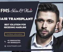 Perfect Hair Restoration with Hair Transplantation