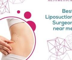 Transform Your Body: Discover the Top Liposuction Surgeon Near You