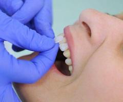 Dental Implants Cosmetic Dentistry - 1