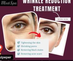 Wrinkle Treatment in Warrenton | Lifestyle’s MedSpa