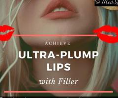Ultra Plump Lips Treatment in Culpeper | Lifestyle’s MedSpa - 1