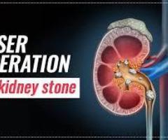 Laser Operation For Kidney Stone | World of Urology