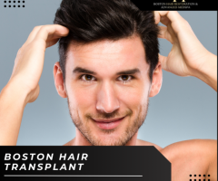 Hair Loss Solution: Why Boston's Hair Transplant Clinic is the Best