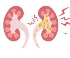 What is The Most Common Cause of a Kidney Infection