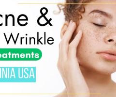 A Guide to Main Acne Treatments Warrenton VA