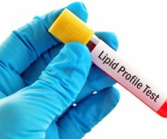 Low-Cost Lipid Profile Test in Delhi - Contact Us Now!