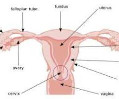 Top treatment for causes of a swollen uterus