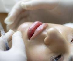 Dermal Fillers | Lip & Wrinkle Fillers Clinic | Lifestyle’s MedSpa