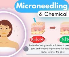 Micro-Needling and Chemical Peels: Stimulating Renewal Skin