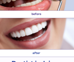 Find Top dentist in Jaipur at justcallz