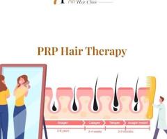 Hair Regeneration Treatment in Fresno CA - 1