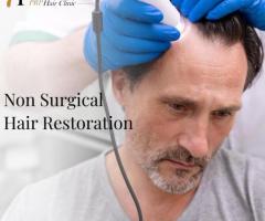 Non Surgical Hair Replacement For Men in Fresno