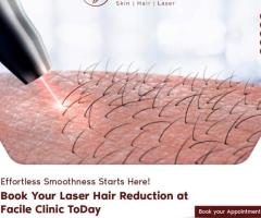 Best Laser hair removal treatment in kothapet| Facile clinic | Kondapur