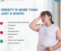 Best Obesity Treatment Doctors In Hyderabad