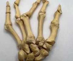 Real Human Left Hand 102 Bones For Sale