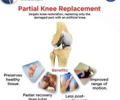 Partial Knee Replacement in Hyderabad