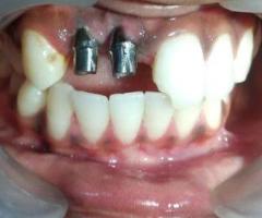 dentist in faridabad sector 9