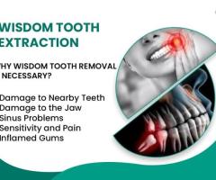 Wisdom Tooth Removal Treatment In Nagaram, Hyderabad | RISUS DENTAL - 1