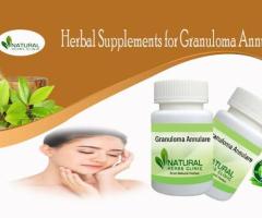 Herbal Supplement for Granuloma Annular