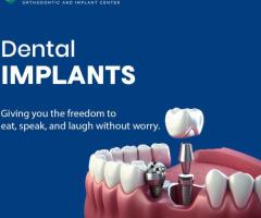 Best dental implants in nagaram | risus dental clinic