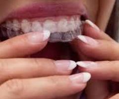 Straighten your teeth with invisible teeth aligners Hampshire | Southampton | Poole